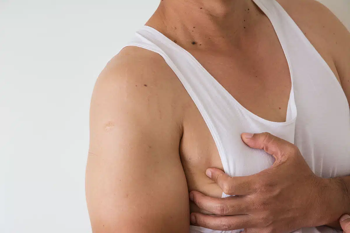 How Podcasters Can Feature Gynecomastia Specialist Doctors on Their Shows